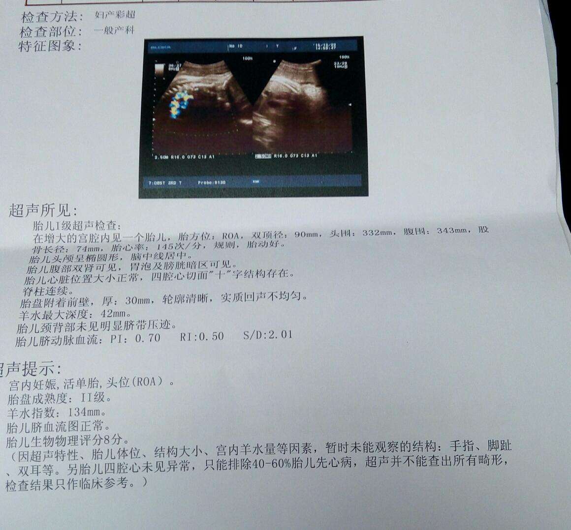 八个月胎儿双顶径标准解析