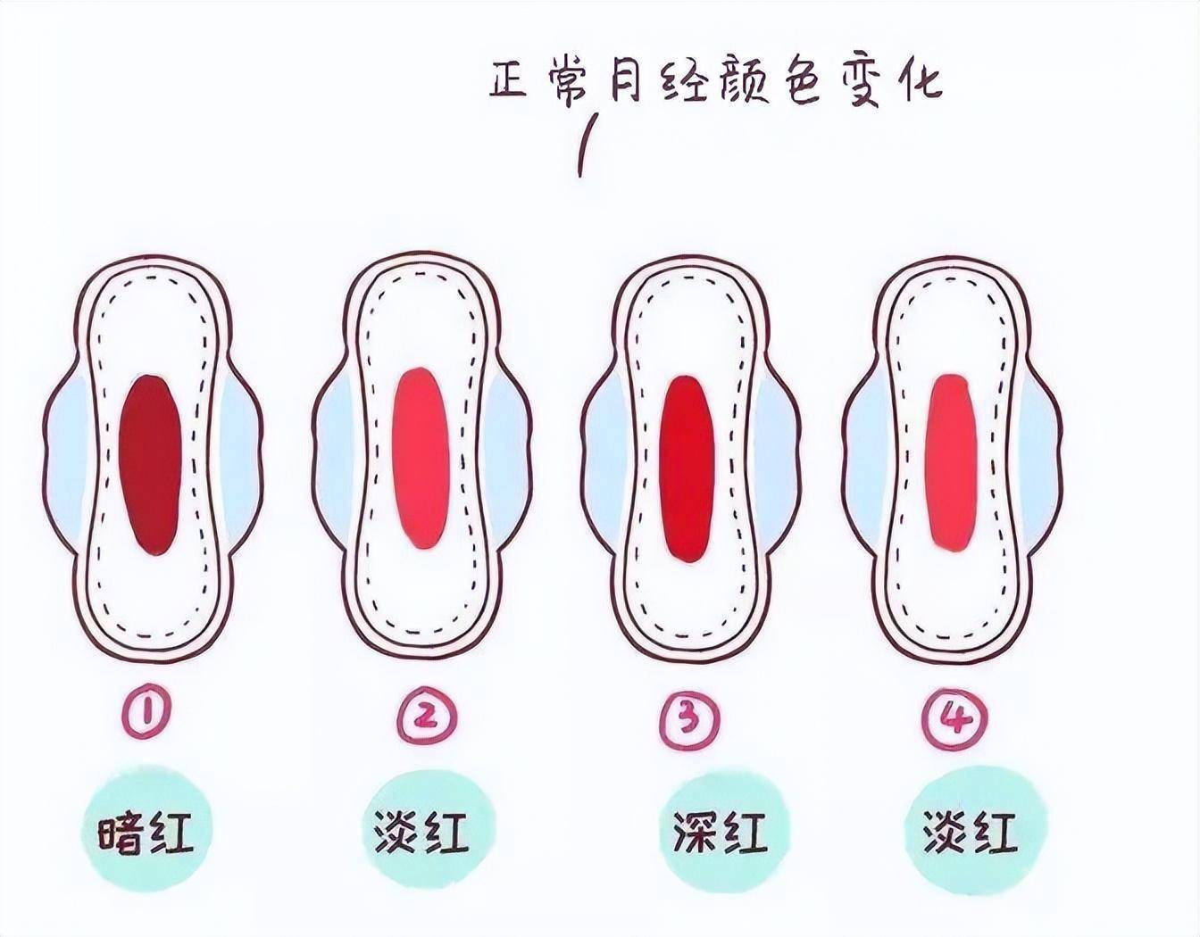 经期半个月后有褐色的观察与理解